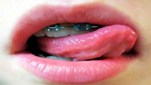 lips of what girls want