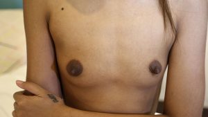 Tiny bare Laos tits